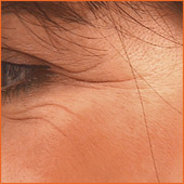 Krähenfüsse Baden-Baden